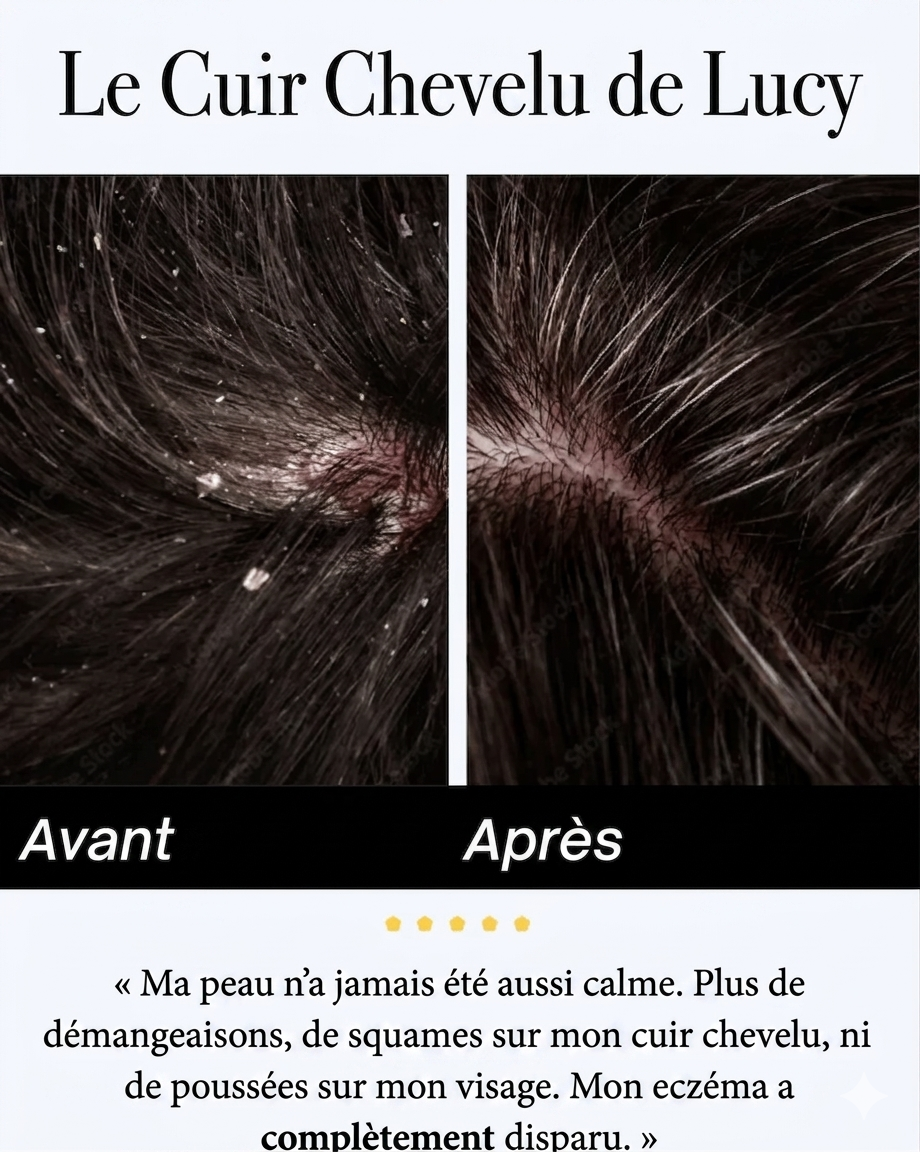 Sérum apaisant naturel