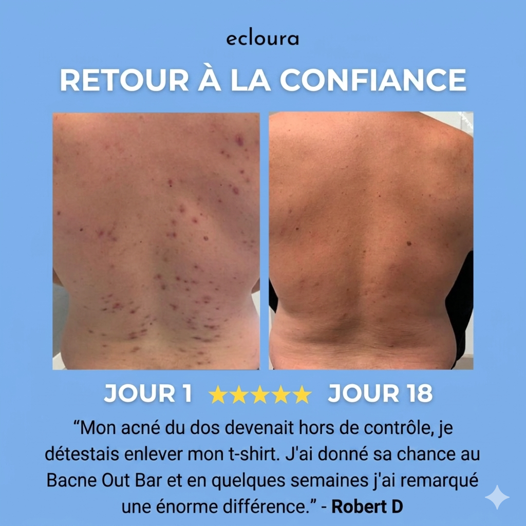 Ecloura™ - Savon anti-acné du dos