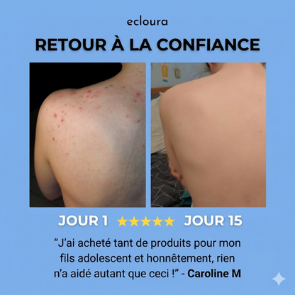 Ecloura™ - Savon anti-acné du dos
