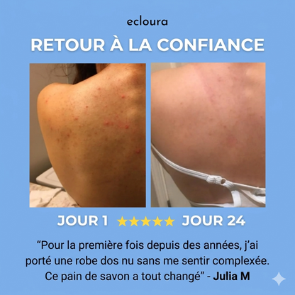 Ecloura™ - Savon anti-acné du dos
