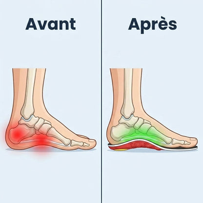 ArcoFlex™ : marchez sans douleur, du matin au soir