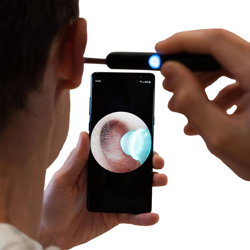 Clirear : nettoyage des oreilles sûr et doux