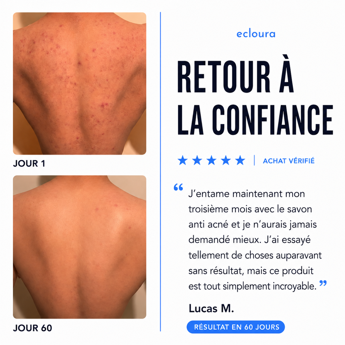 Ecloura™ - Savon anti-acné du dos