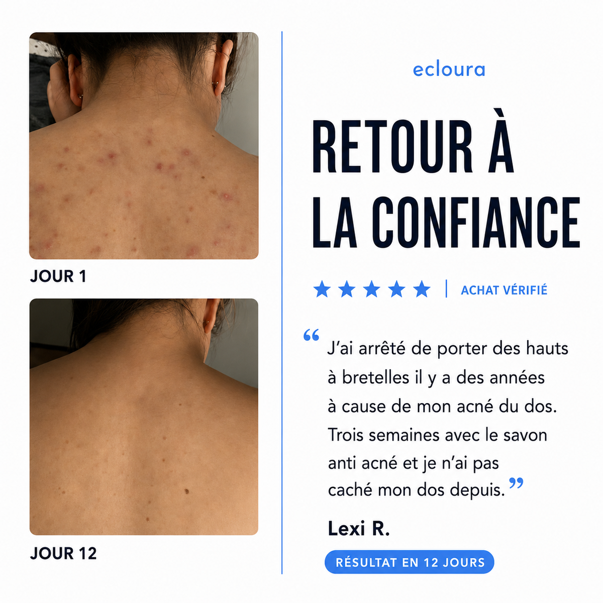 Ecloura™ - Savon anti-acné du dos