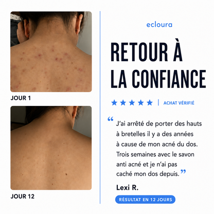 Ecloura™ - Savon anti-acné du dos