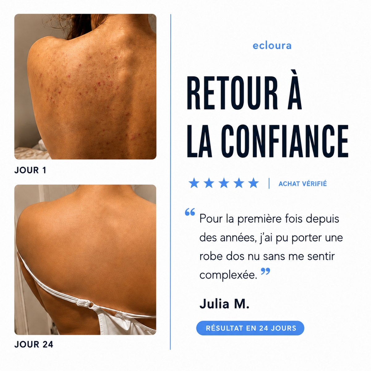 Ecloura™ - Savon anti-acné du dos