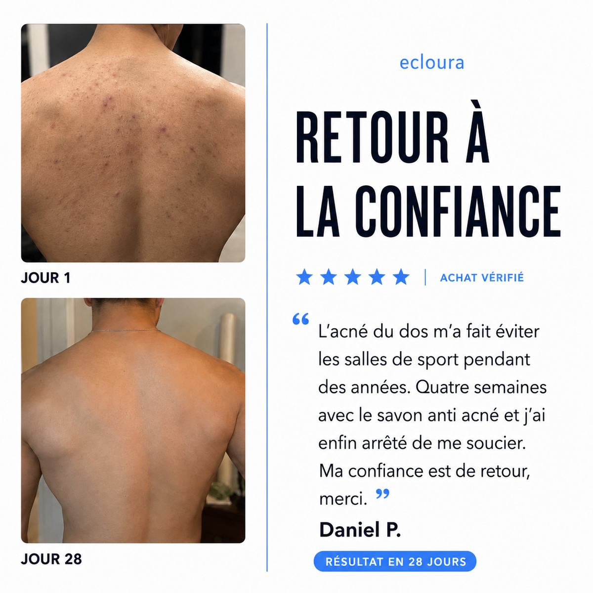 Ecloura™ - Savon anti-acné du dos